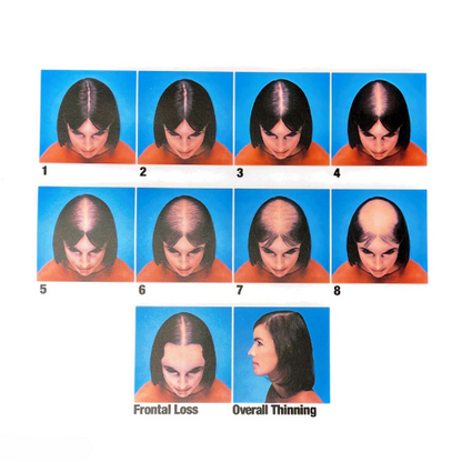 Trichology Poster Bundle